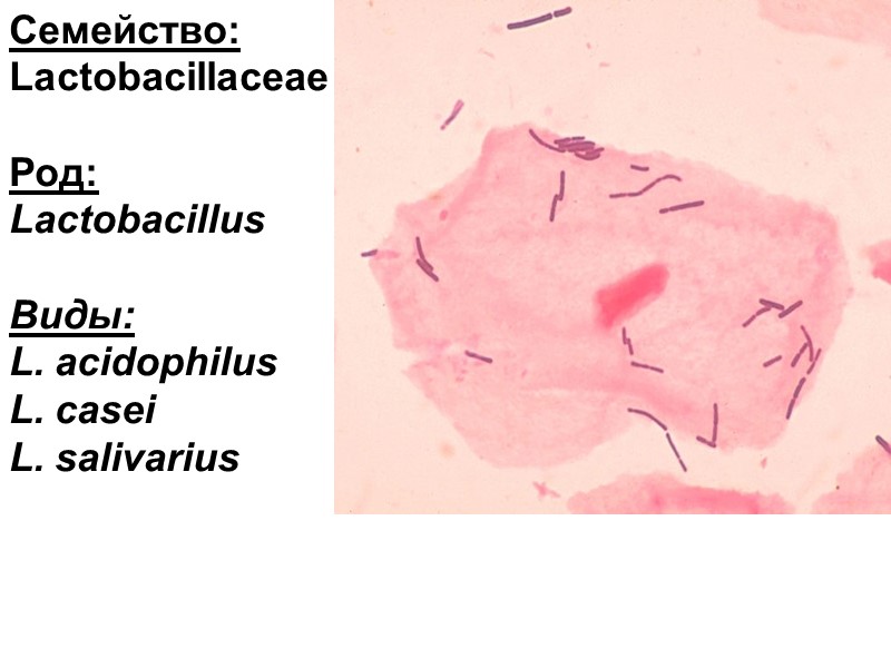Семейство: Lactobacillaceae  Род:  Lactobacillus  Виды: L. acidophilus L. сasei L. salivarius